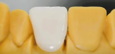 Permanent Crown Resin