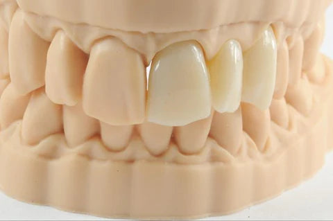 Permanent Crown Resin